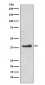 Anti-DKK1 Rabbit Monoclonal Antibody